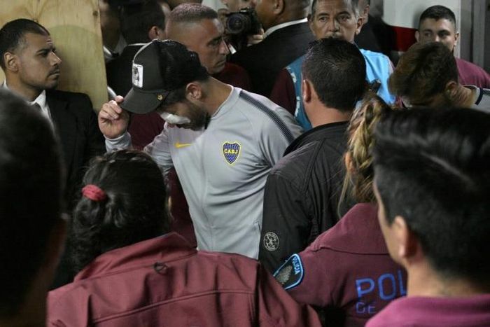 Boca Juniors Pablo Perez wears an eye bandage after hospital treatment to his eye following an attack on his team's bus
