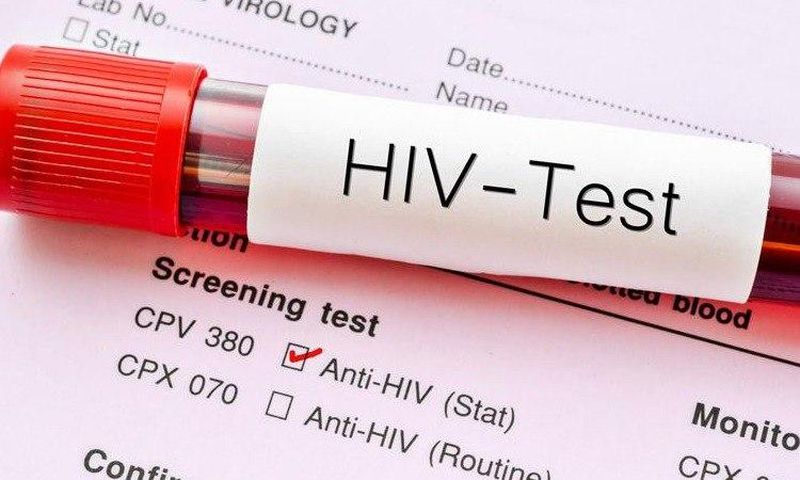 MP reveals he is HIV positive (Video)