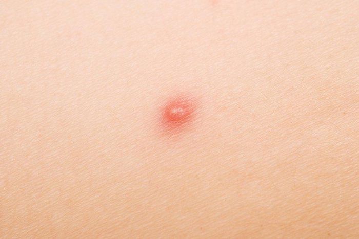 ___6942833___https:______static.pulse.com.gh___webservice___escenic___binary___6942833___2017___7___4___19___opener-gettyimages-155008850-happyfoto