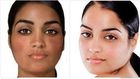 Skin 'bleaching'