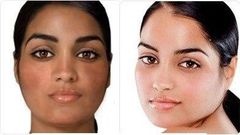 Skin 'bleaching'