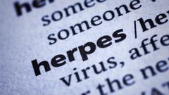 herpes