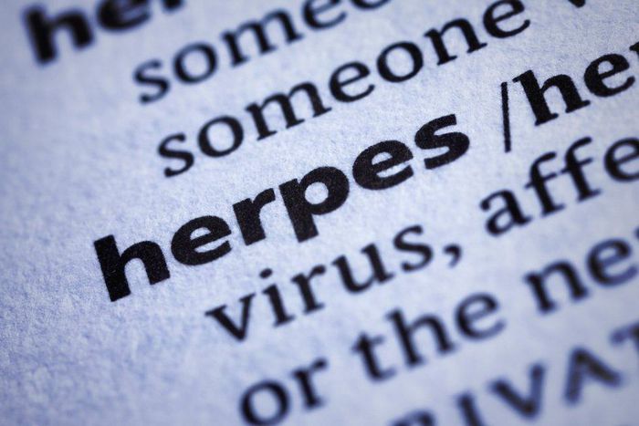 herpes