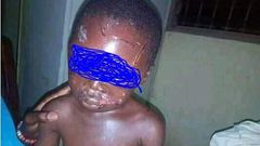 Stepmother brutalises little boy, photos will shake you