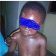 Stepmother brutalises little boy, photos will shake you