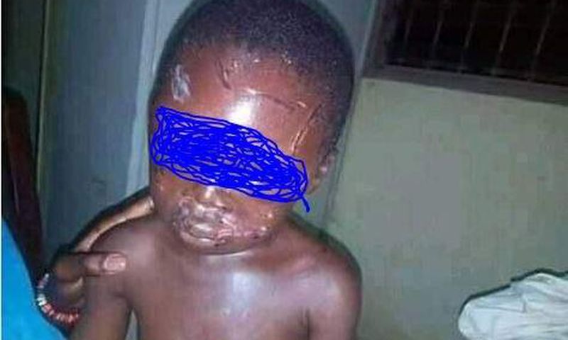 Stepmother brutalises little boy, photos will shake you