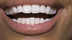 ___9153777___2018___11___30___13___86536100