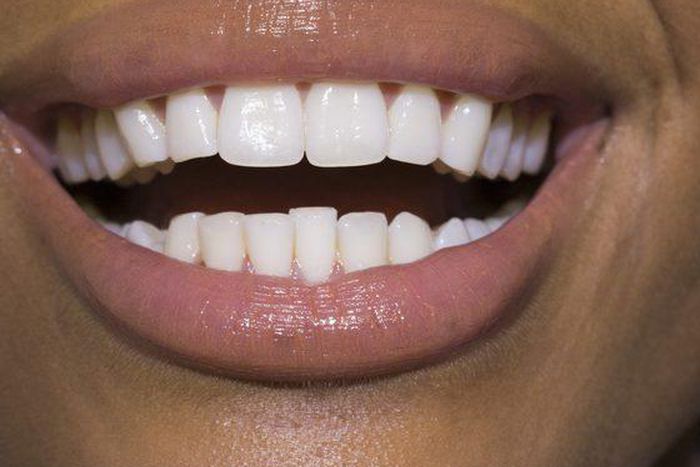 ___9153777___2018___11___30___13___86536100