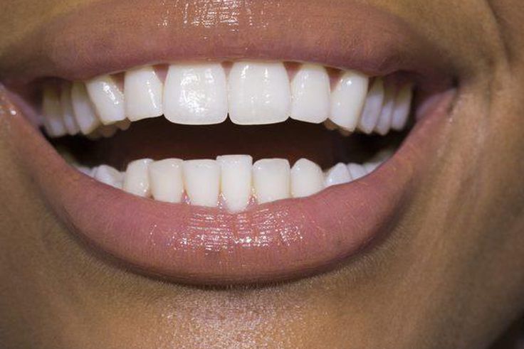 ___9153777___2018___11___30___13___86536100