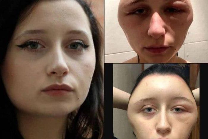 ___9149858___2018___11___29___13___Expands