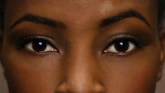 ___7136944___https:______static.pulse.com.gh___webservice___escenic___binary___7136944___2017___8___12___16___Acne-scar-fade-creams-for-black-women