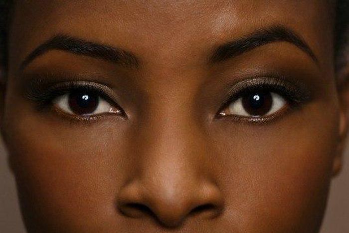 ___7136944___https:______static.pulse.com.gh___webservice___escenic___binary___7136944___2017___8___12___16___Acne-scar-fade-creams-for-black-women