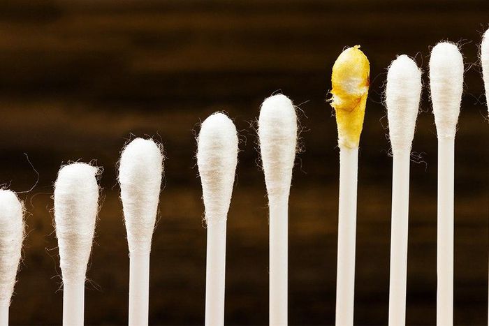 Doctors really, really want you to stop sticking q-tips and toothpicks in your ears