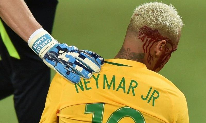 Brazil's Neymar bleeds after being injured in the face during the 2018 World Cup football qualifier against Bolivia in Natal, Brazil, on October 6, 2016