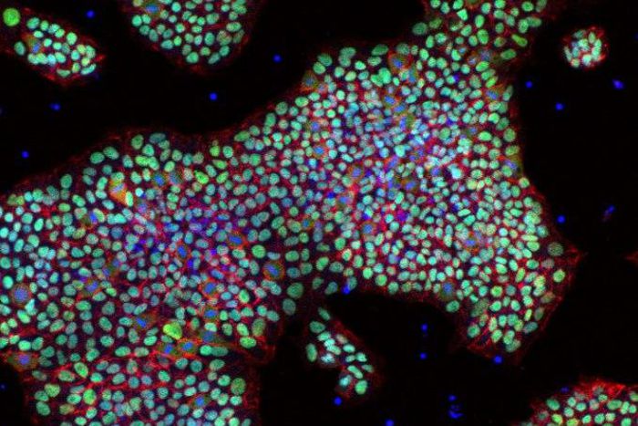 An image of human pluripotent stan cells in IαI media.