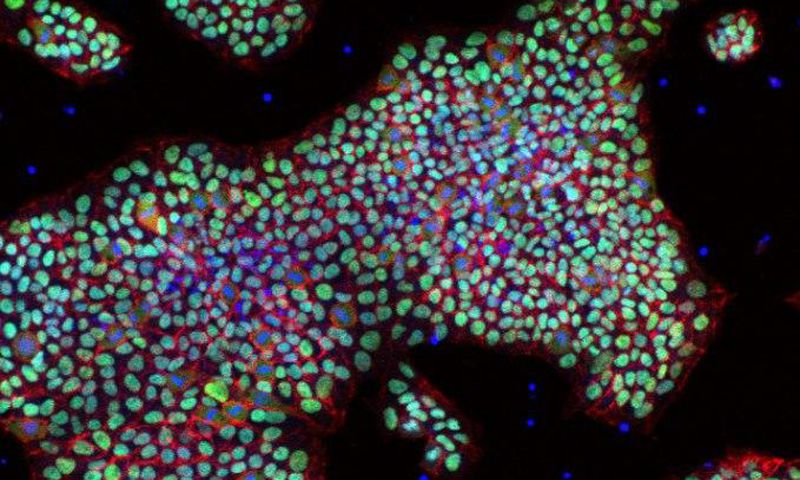 An image of human pluripotent stan cells in IαI media.
