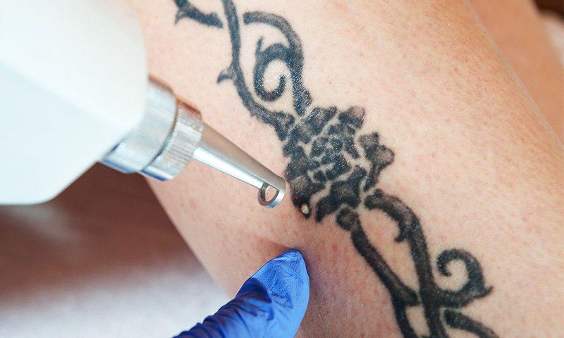 There are creams and balms that promise to lighten or erase a tattoo.