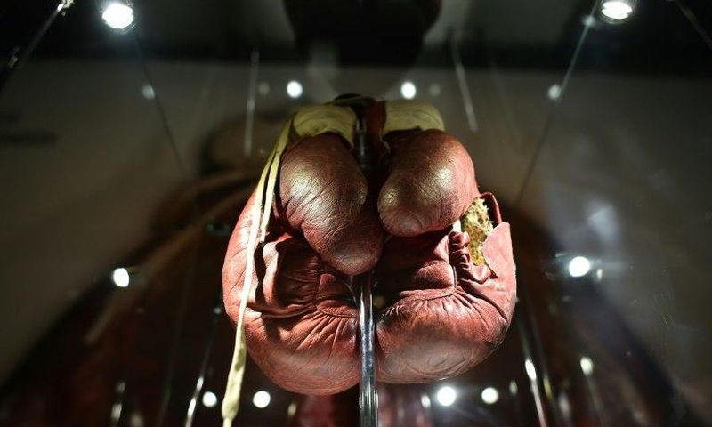 A pair of split boxing gloves worn by Muhammad Ali during his 1963 fight against Henry Cooper -- the British boxer won that bout but lost a susequent fight on points