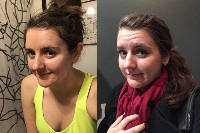 ___6661392___https:______static.pulse.com.gh___webservice___escenic___binary___6661392___2017___5___18___16___facials-every-week-before_0