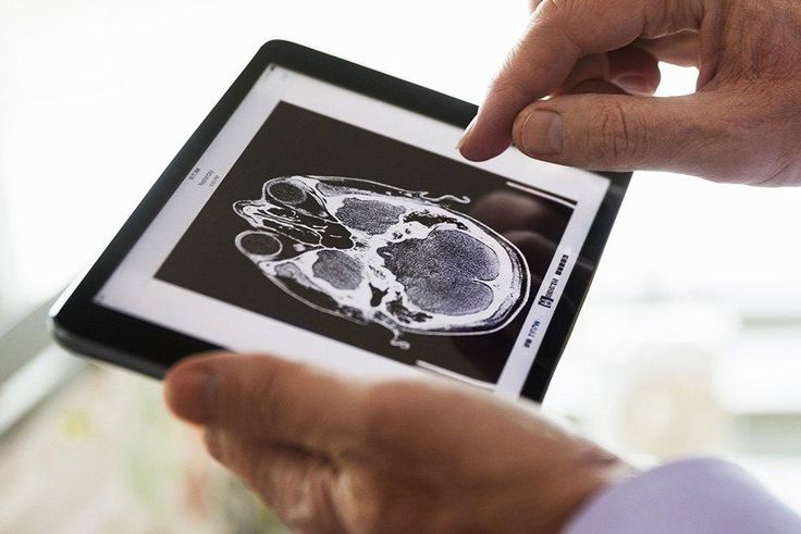 ​overweight diabetics and brain changes