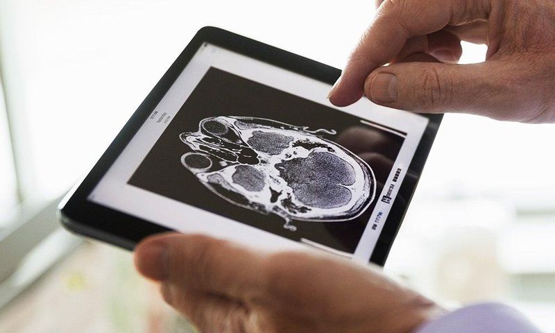 ​overweight diabetics and brain changes