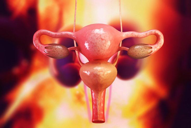 Are your periods irregular? You could have this syndrome and not even know it