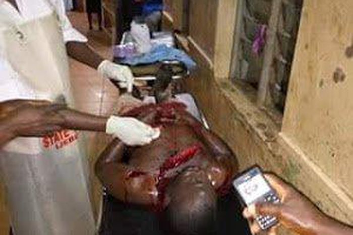 The woman reportedly stabbed the man after sex.