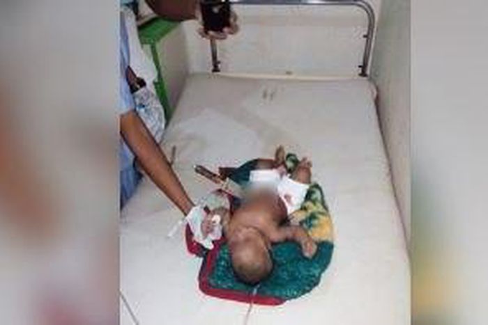 The eight-month-old baby pictured with the knife sticking out of his stomach