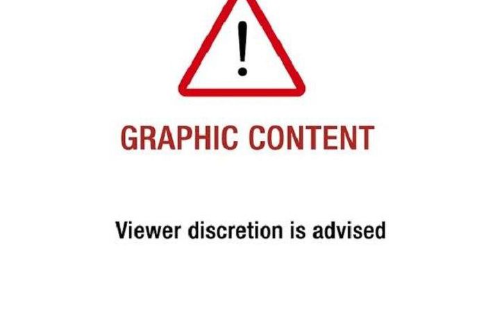 You are about to view picture(s) that may be disturbing.