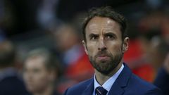 England's Interim manager Gareth Southgate said injured midfielder Adam Lallana is an "intelligent, very talented footballer who's adding goals to his game for England"