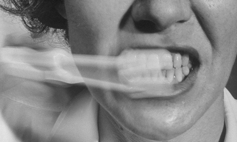 White spots on the teeth.