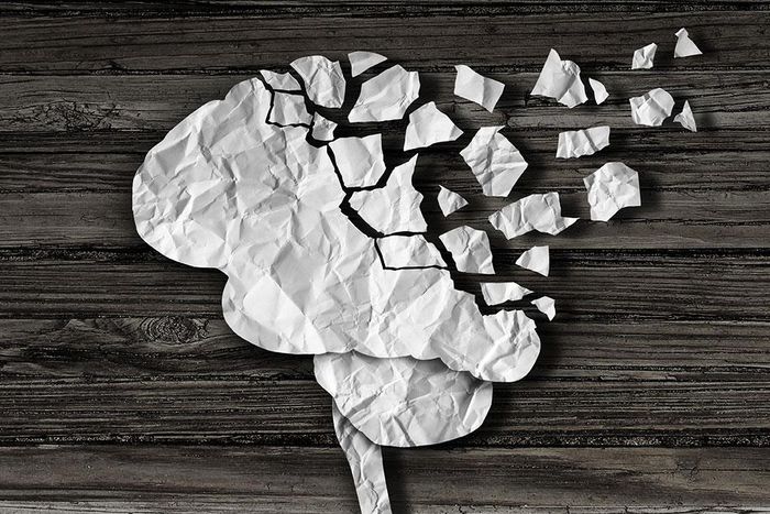 Alzheimer's disease.