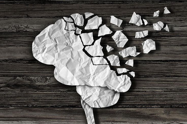 Alzheimer's disease.