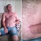 ___6735054___https:______static.pulse.com.gh___webservice___escenic___binary___6735054___2017___5___25___16___man-mangled-hand-sewn-into-stomach