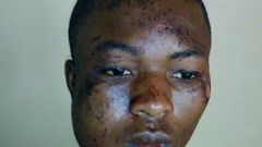 Injured armed robber escapes from hospital  (Picture credit: Daily Graphic)