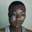 Injured armed robber escapes from hospital  (Picture credit: Daily Graphic)