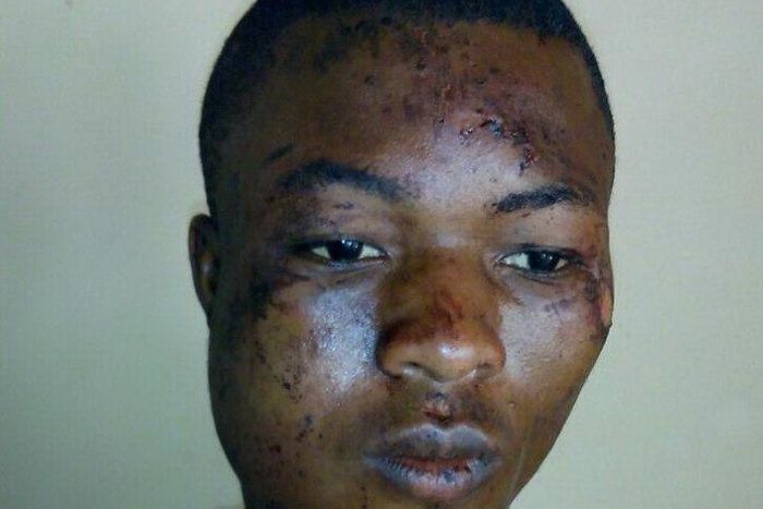 Injured armed robber escapes from hospital  (Picture credit: Daily Graphic)