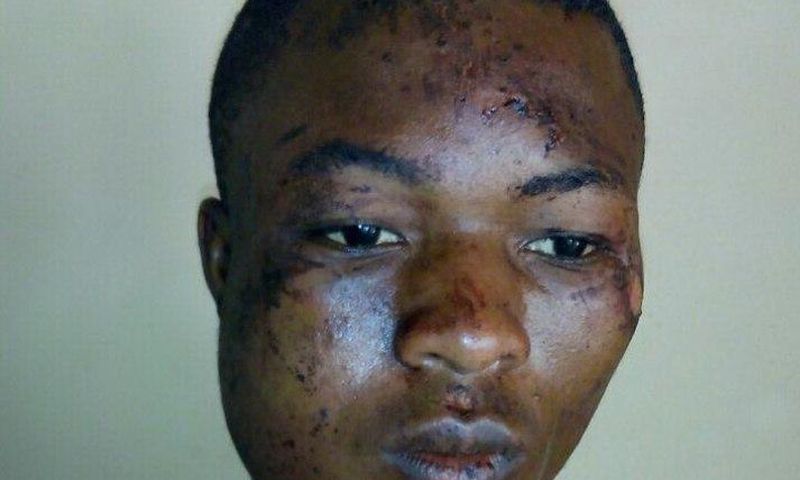 Injured armed robber escapes from hospital  (Picture credit: Daily Graphic)