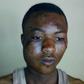 Injured armed robber escapes from hospital  (Picture credit: Daily Graphic)