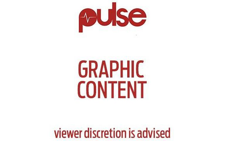 You are about to view a content that may be disturbing.