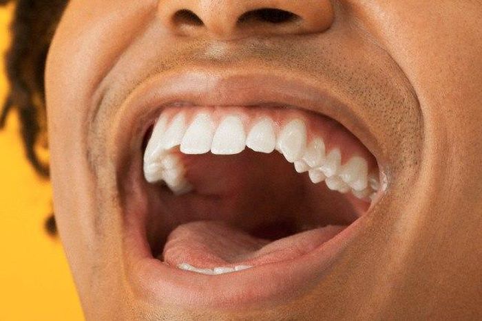 Good dental hygiene is necessary for overall health