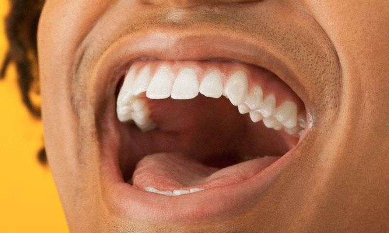 Good dental hygiene is necessary for overall health