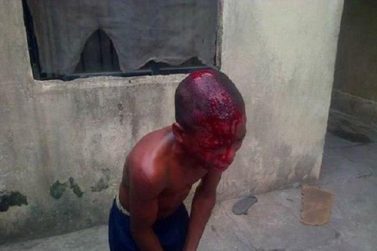 The bloodied houseboy