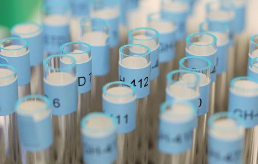 ___4807233___https:______static.pulse.com.gh___webservice___escenic___binary___4807233___2016___10___7___9___doping-cropped_1qx2oqkom13s71edtwdx8vlmqx