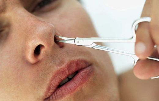 ___6249848___https:______static.pulse.com.gh___webservice___escenic___binary___6249848___2017___2___19___22___nose-hair-two-types-b