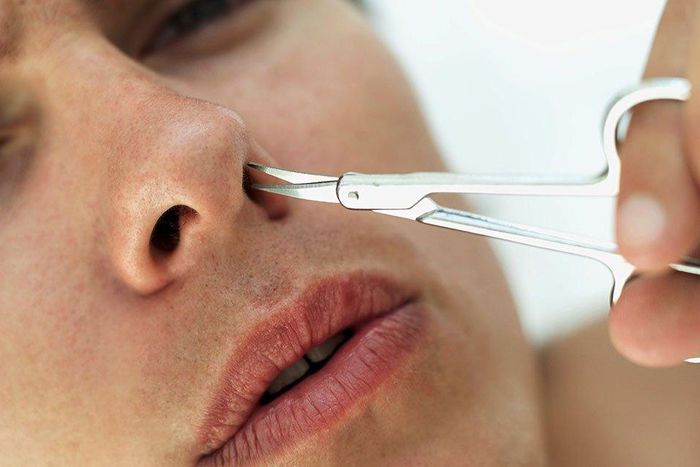 ___6249848___https:______static.pulse.com.gh___webservice___escenic___binary___6249848___2017___2___19___22___nose-hair-two-types-b