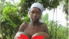 11 year old suffering from hypertrophy