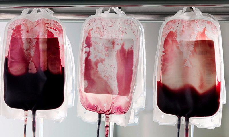 Scientists discover breakthrough for HIV.