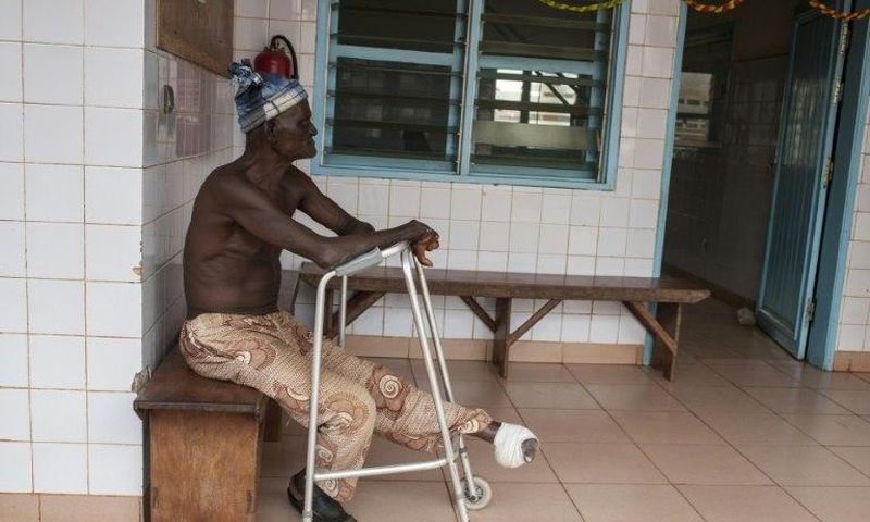 A man who lost his left foot to leprosy, waits for treatment at the Raoul Follereau Foundation facility in Pobe
