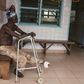 A man who lost his left foot to leprosy, waits for treatment at the Raoul Follereau Foundation facility in Pobe